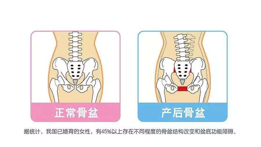 重庆主城产后康复哪家培训机构比较好？