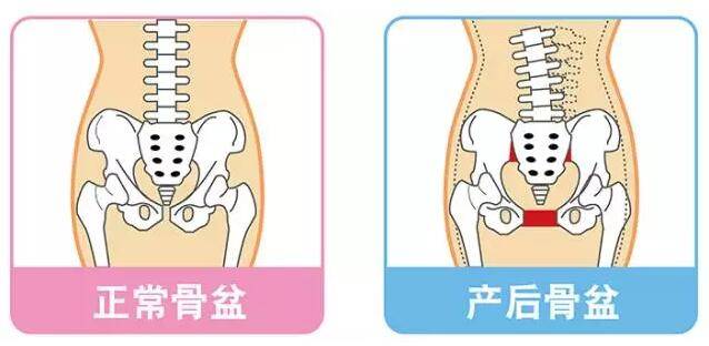 产后康复培训哪家好？