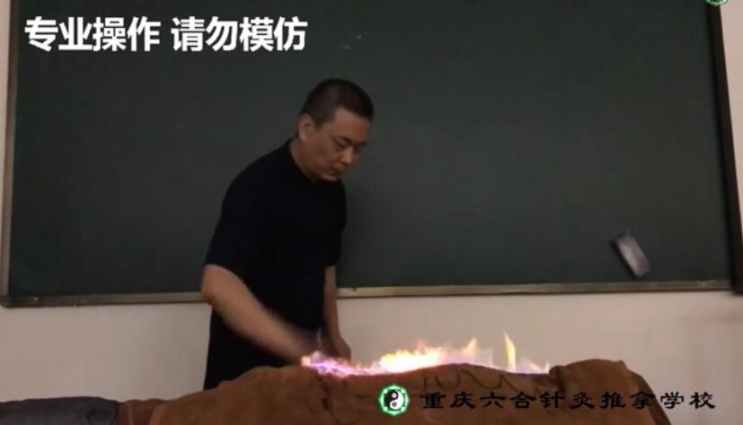 火疗好学吗？重庆哪里有火疗课程？
