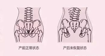 重庆六合学校带您认识产后修复的几大误区