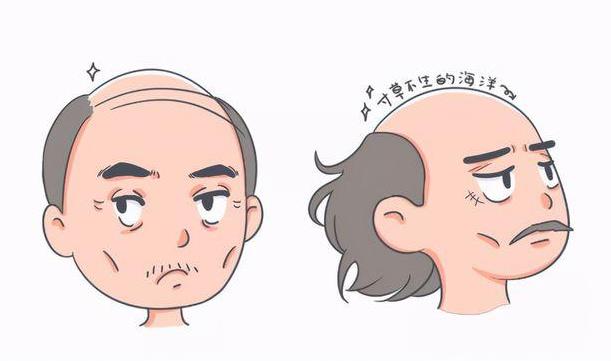 中年男人易脱发 中医教你护发方法