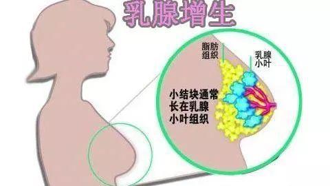 刮痧能治疗乳腺小叶增生吗？